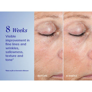 iS Clinical Active Peel System
