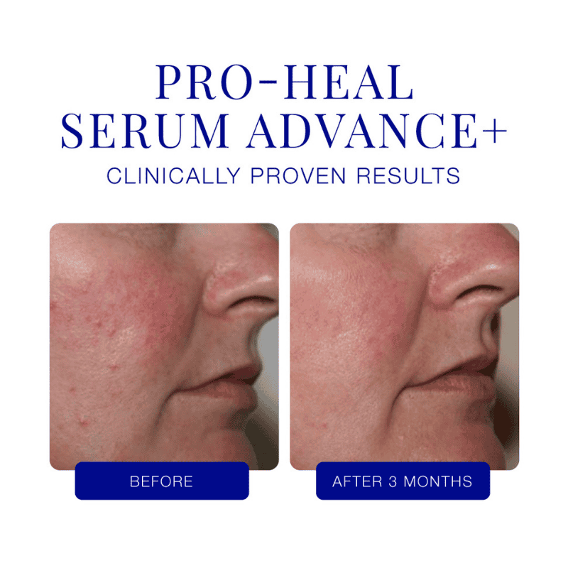 iS Clinical Pro HEAL Serum Advance